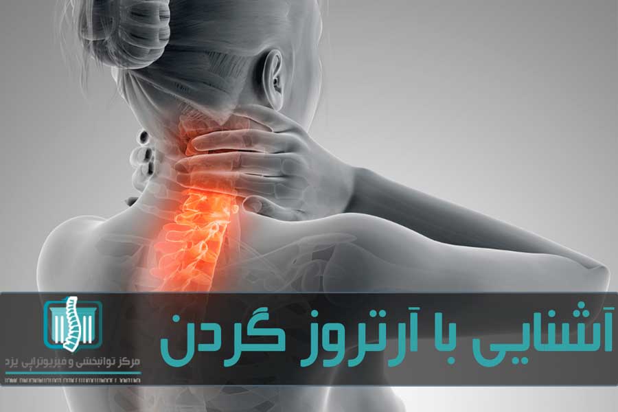آرتروز یکی از شایع‌ترین بیماری‌های ناحیه گردن است
