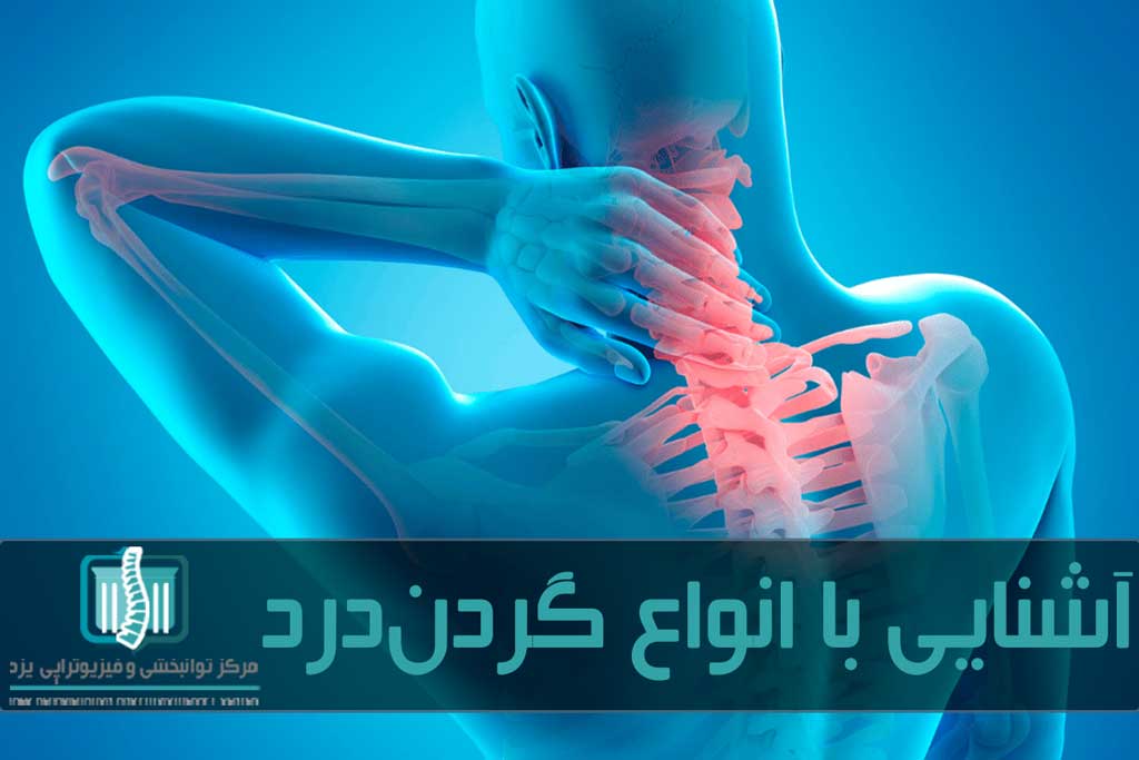 گردن درد ممکن است در اثر هر ناهنجاری، التهاب یا جراحت در اجزای گردن ایجاد شود