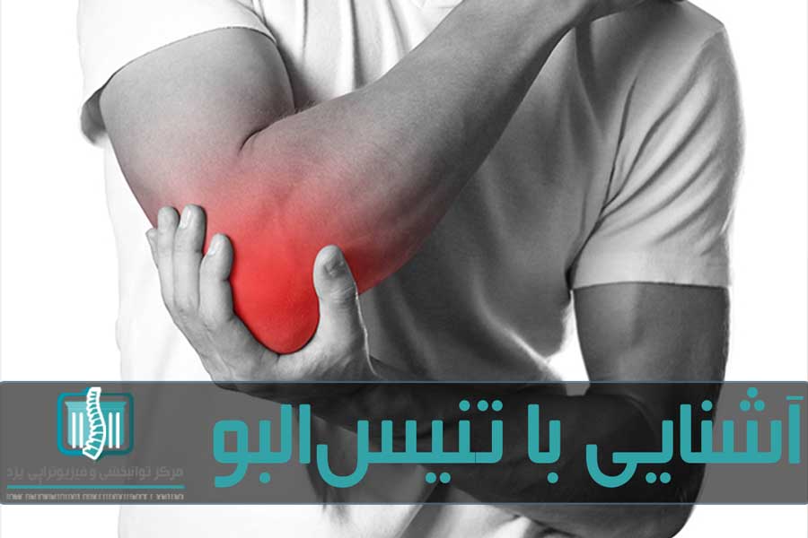 تنیس البو یا آسیب آرنج تنیس بازان درد ناحیه خارجی آرنج است